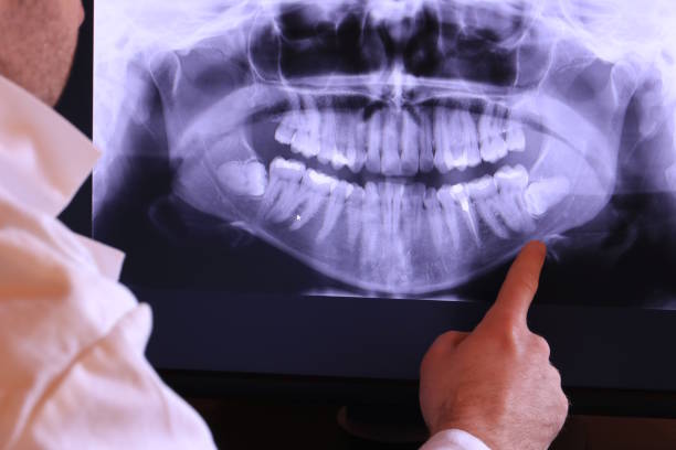 Best Dentist for Tooth Abscess  in Valley Center, KS